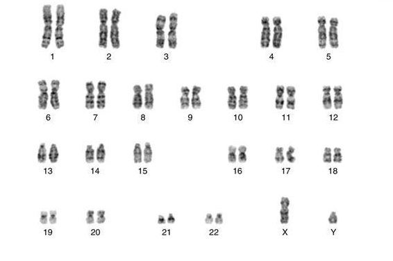染色体多态